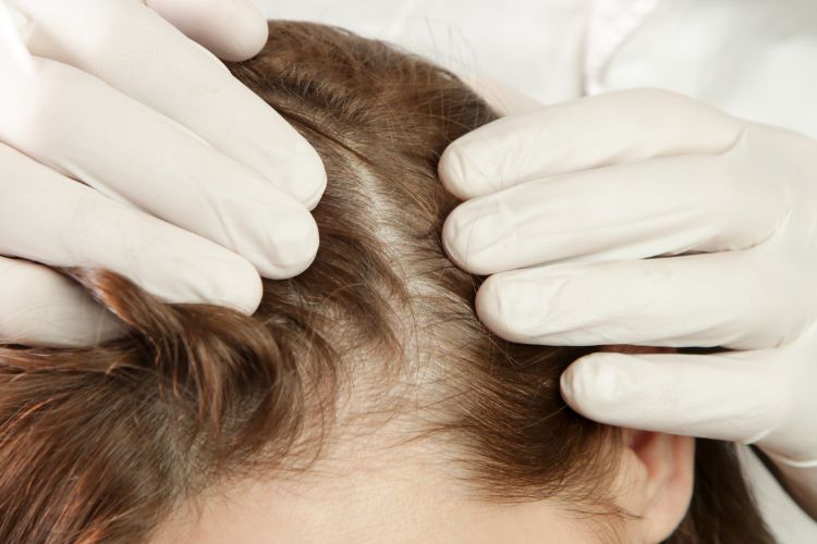 diagnostico capilar por una caida de cabello